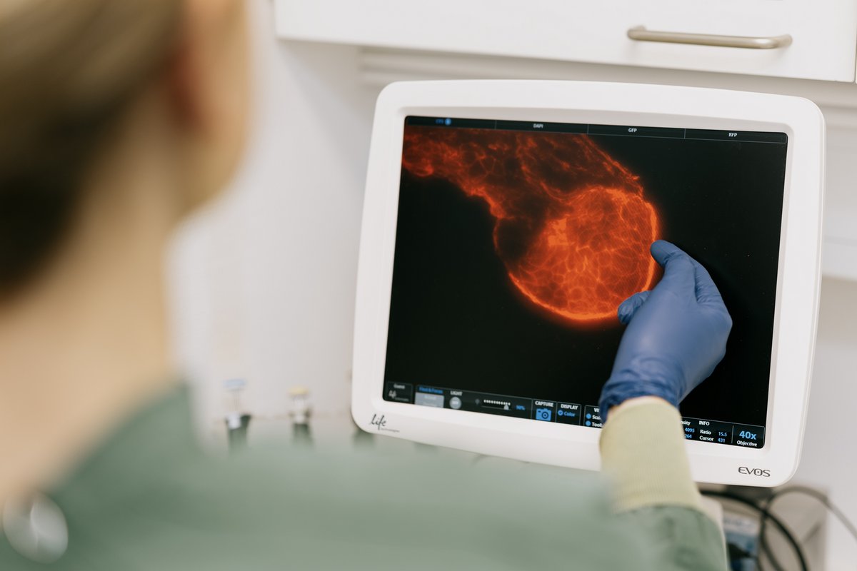 Hun prøver at finde ud af, hvordan parasitten påvirker tarmens celler. Hun har heldigvis gode studiekammerater, hun kan sparre med og hun deler sine opdagelser med en forskningsgruppe på universitetet. På billedet ser hun på tarmens celler indefra. ”Vores håb er, at vi kan bruge det til at udvikle ny medicin,” siger hun. 