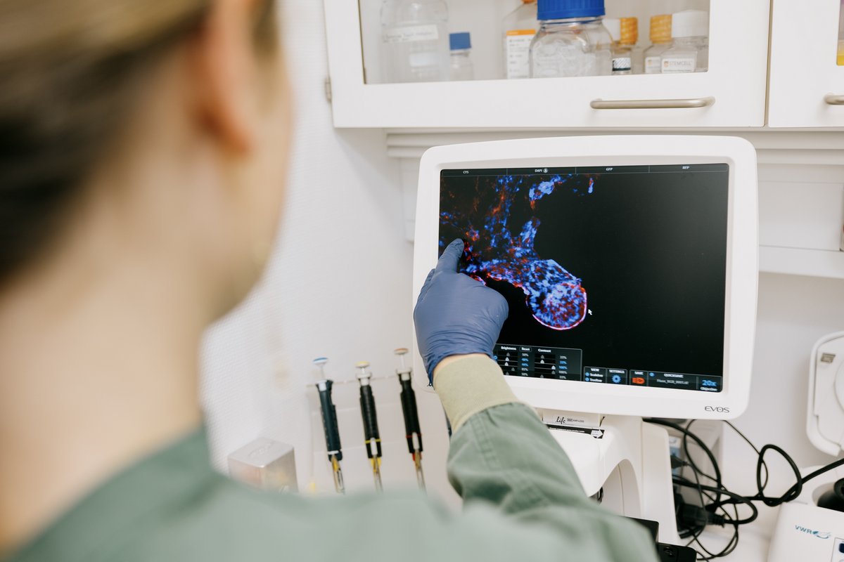 Hun bruger organmodellerne af tarmen til at se, hvordan dens immunsystem udvikler sig på forskellige måder. ”Det er super interessant. Jeg glæder mig hver dag, jeg skal i laboratoriet,” siger hun.  